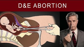 Он провел 1200 абортов. И показал, как это выглядит на самом деле